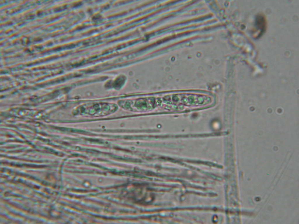 Sconosciuto (cfr. Ascocoryne sp.)